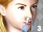 Die Anwendung des NASALINE® Nasenspül-Systems, 3. Schritt